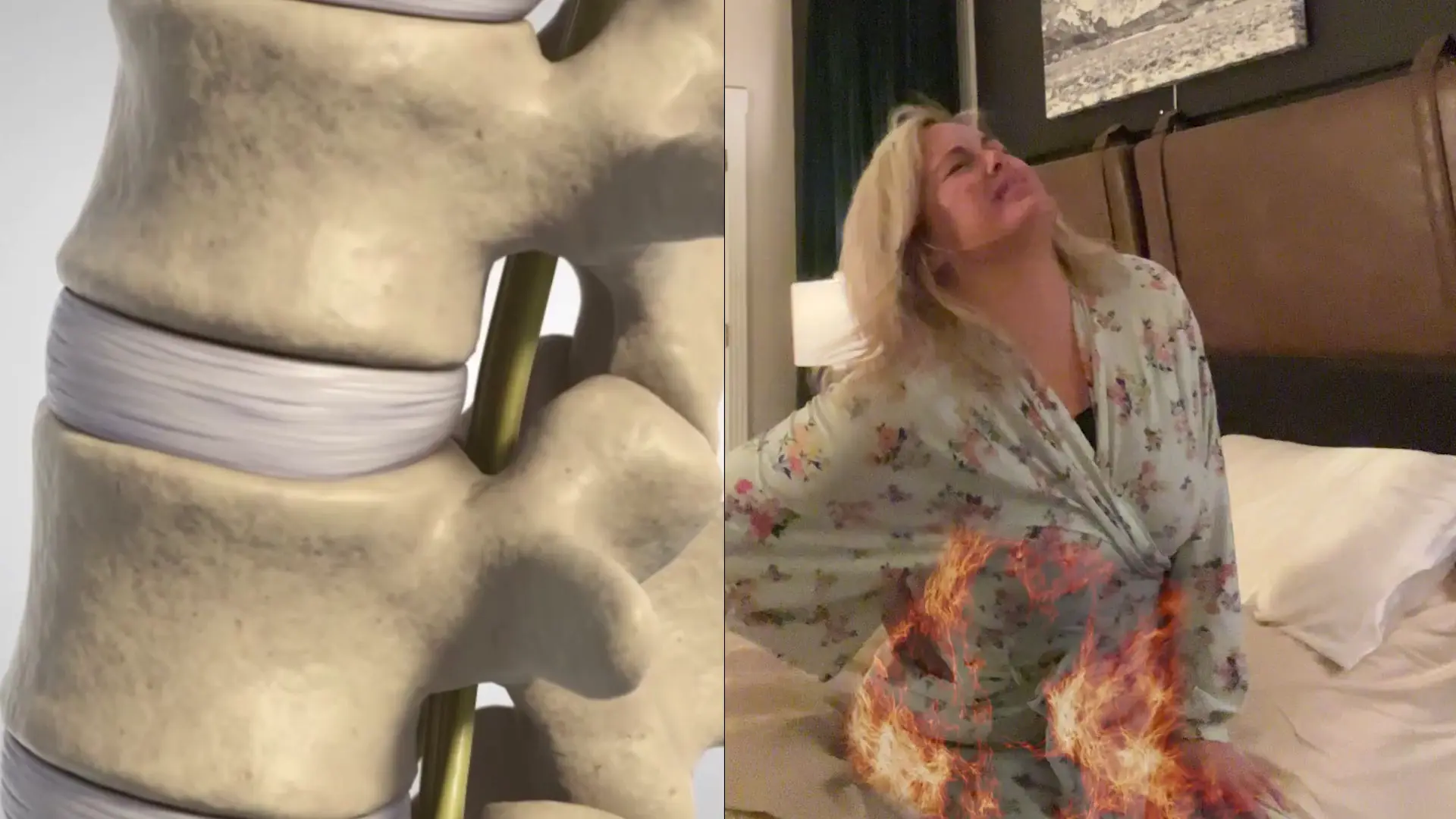 Woman suffering from chronic back pain holding her lower back in pain